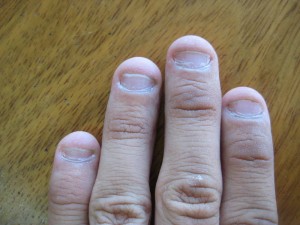 вот так выглядят обгрызенные ногти